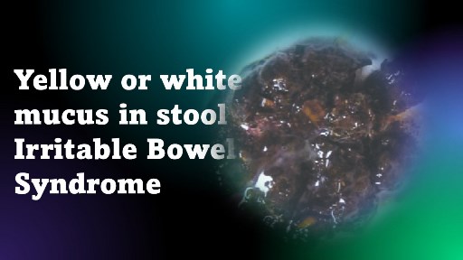 Yellow or white mucus in stool in Irritable